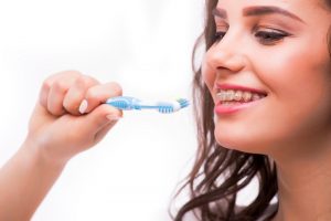 Maintain Straight Teeth After Braces